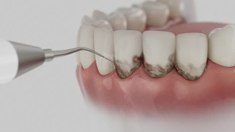 Reliable Dental Implants contractor in Essex, IL by Smile Center Dentistry